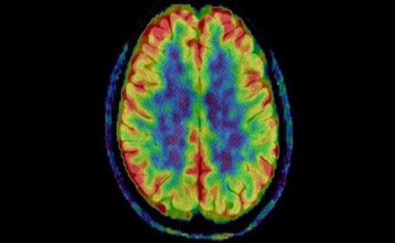 Alzheimer e Parkinson: una PET di nuova generazione aiuterà i medici nelle cure