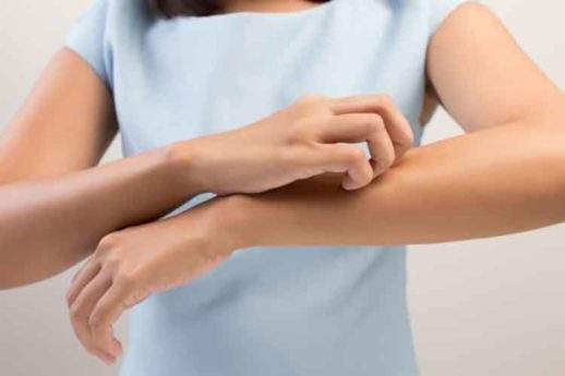 Psoriasi: il menù “salva-pelle” per le festività natalizie