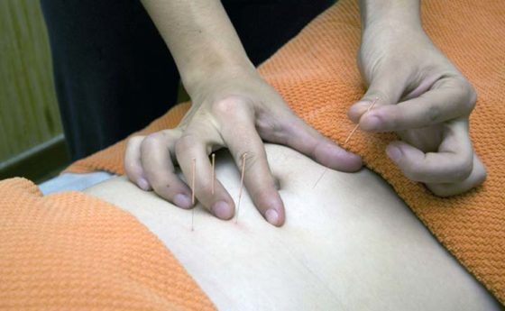 Stop alle vampate con l’agopuntura