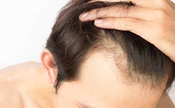 La salute dei capelli passa anche dal tuo frigo